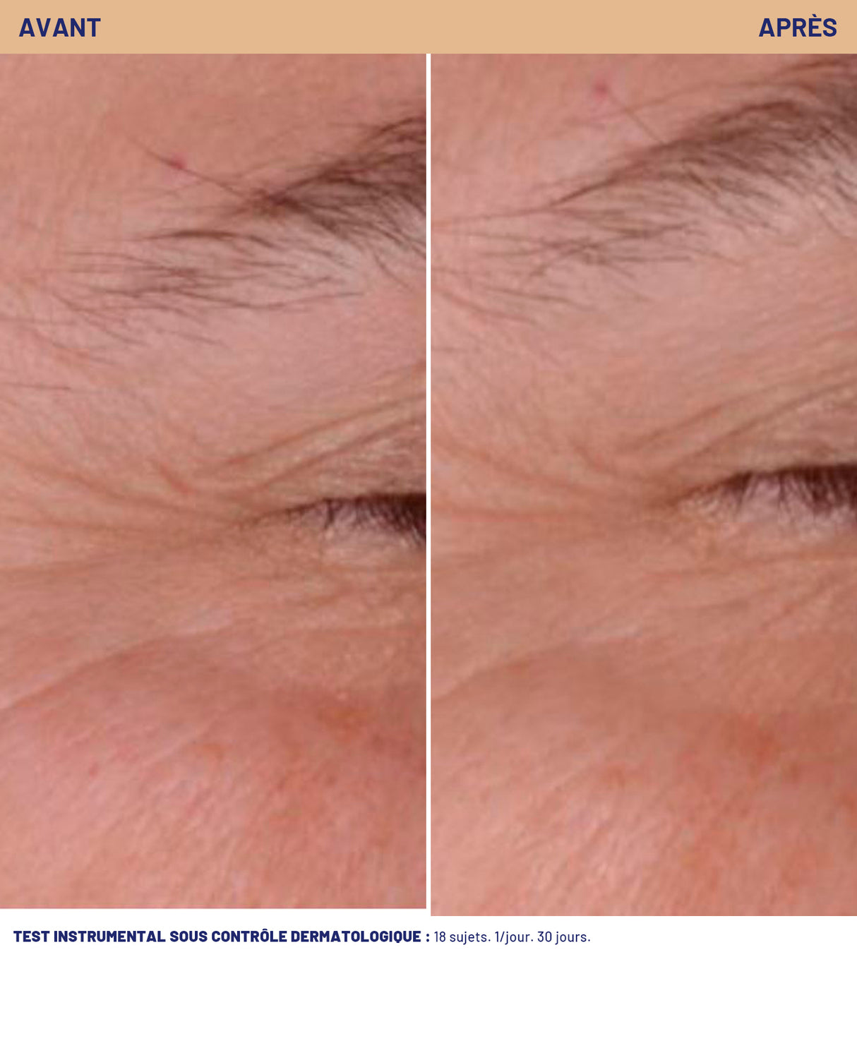 Soin correction rides-éclat Soins de nuit Soskin