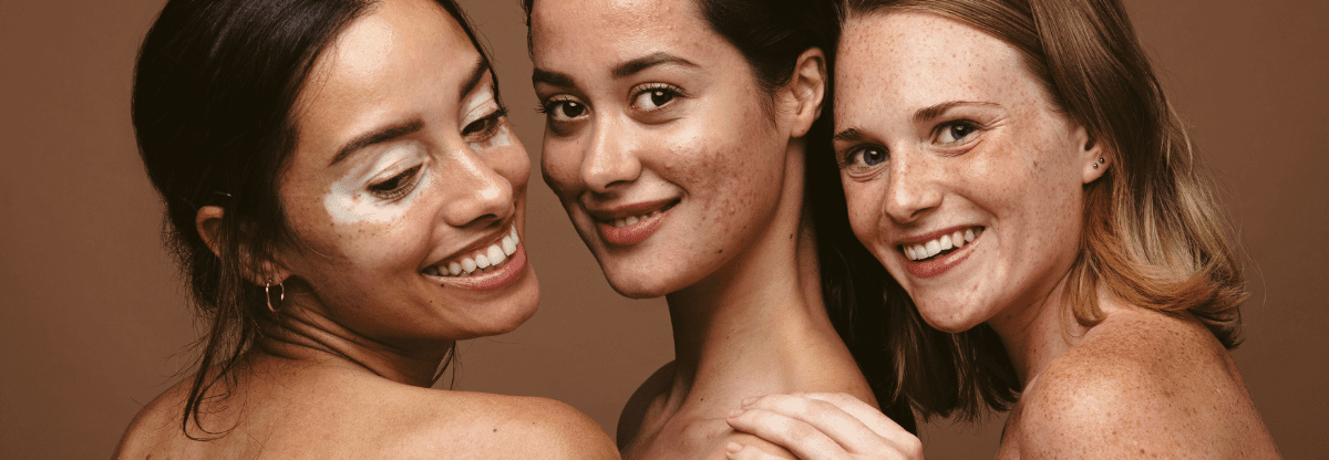 Boutons sur le visage : Guide complet sur l’acné et les routines de soin