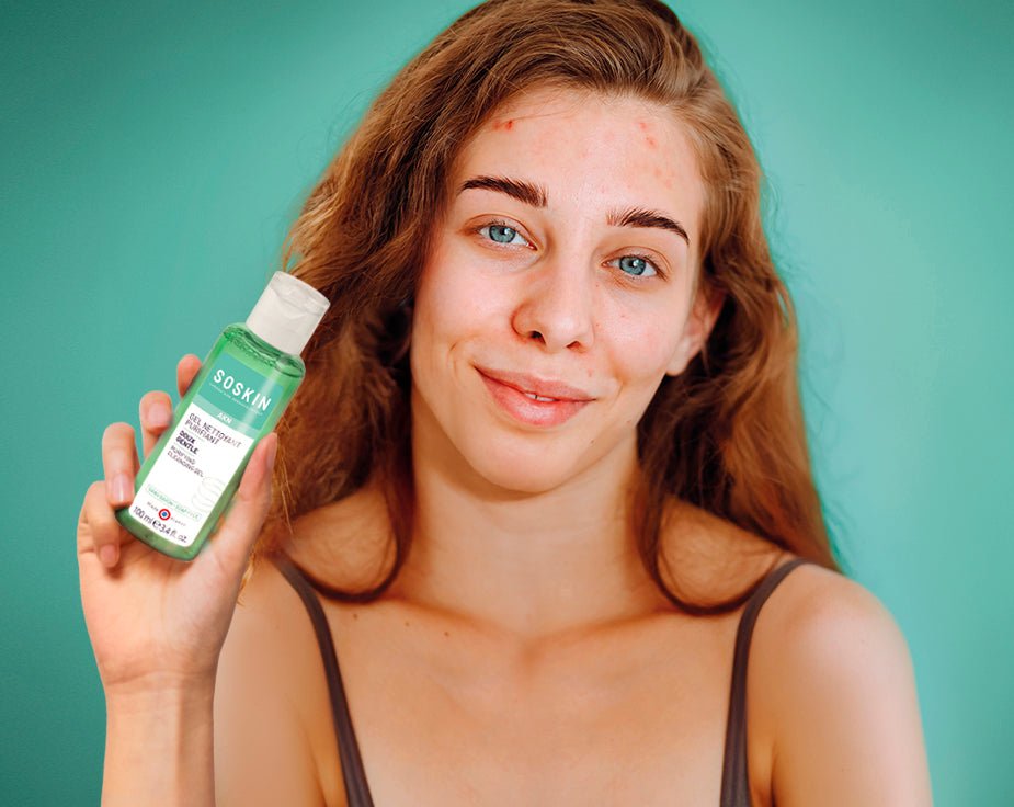 Skin type vs skin condition: complete guide to distinguishing them – SOSKIN