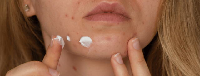 Peau grasse : Comment adopter une protection solaire zéro brillance ?