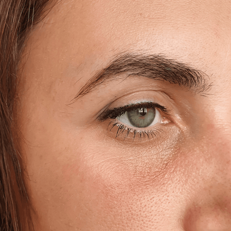 Cernes noirs vs cernes violets vs cernes bruns : comment les différencier et les traiter ?