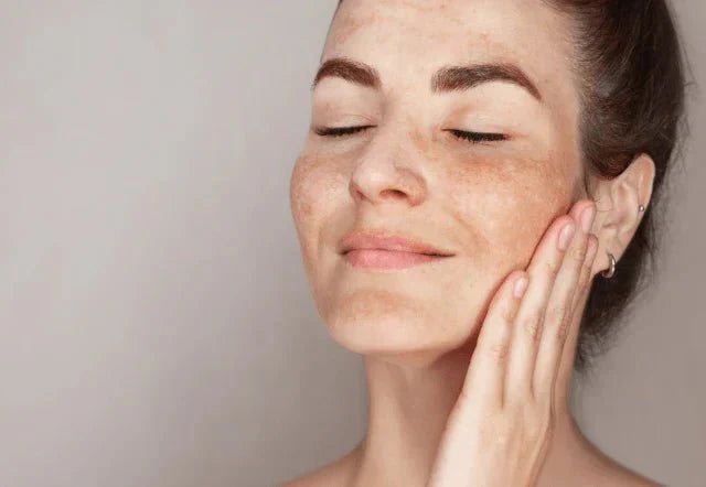 Comment lutter contre les radicaux libres pour une peau préservée