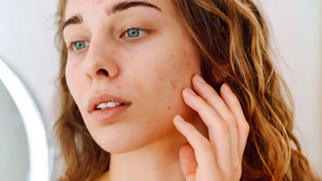 Les différents types de peau : découvrez 4 astuces d’expert pour connaître le vôtre