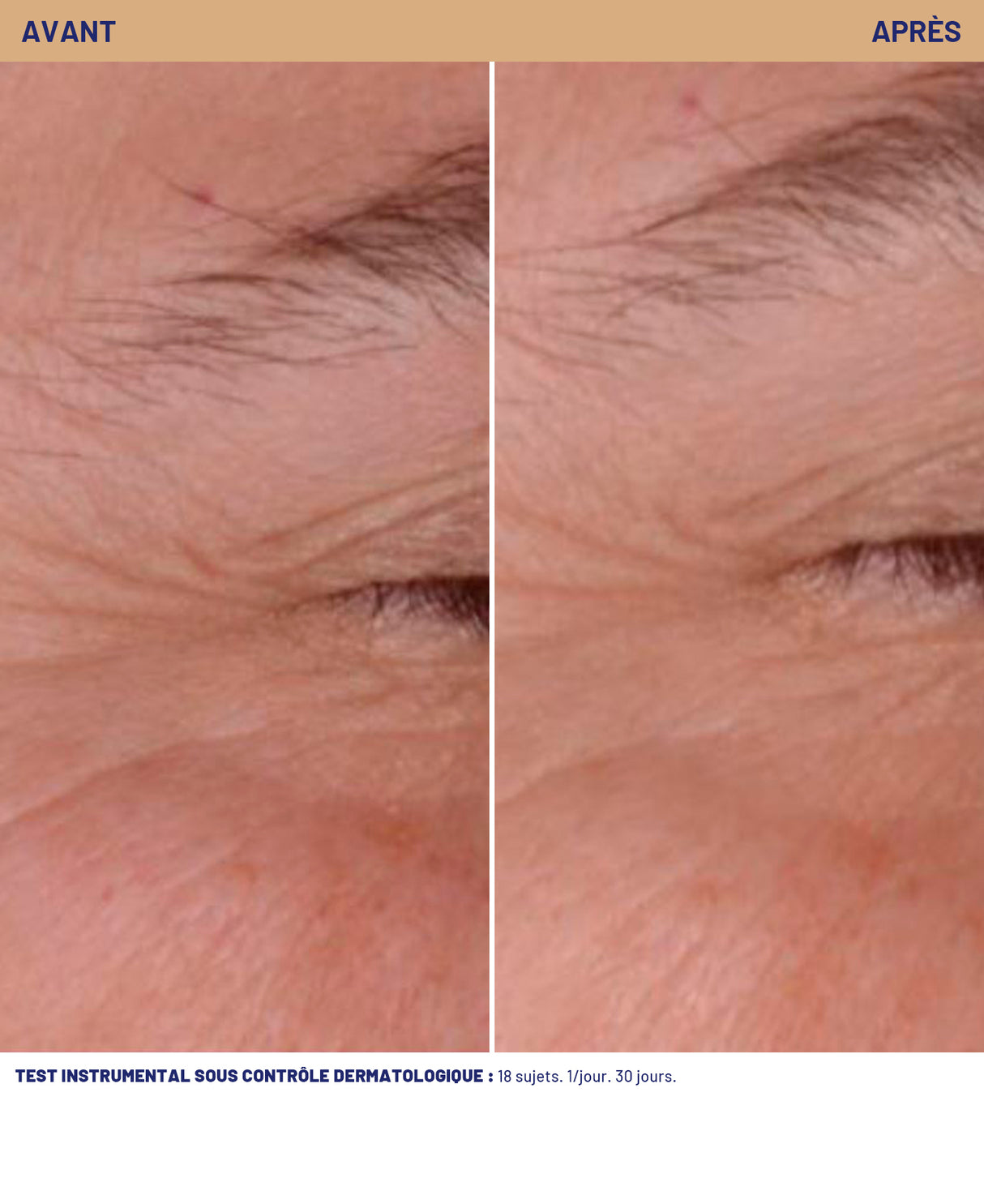 Soin correction rides-éclat