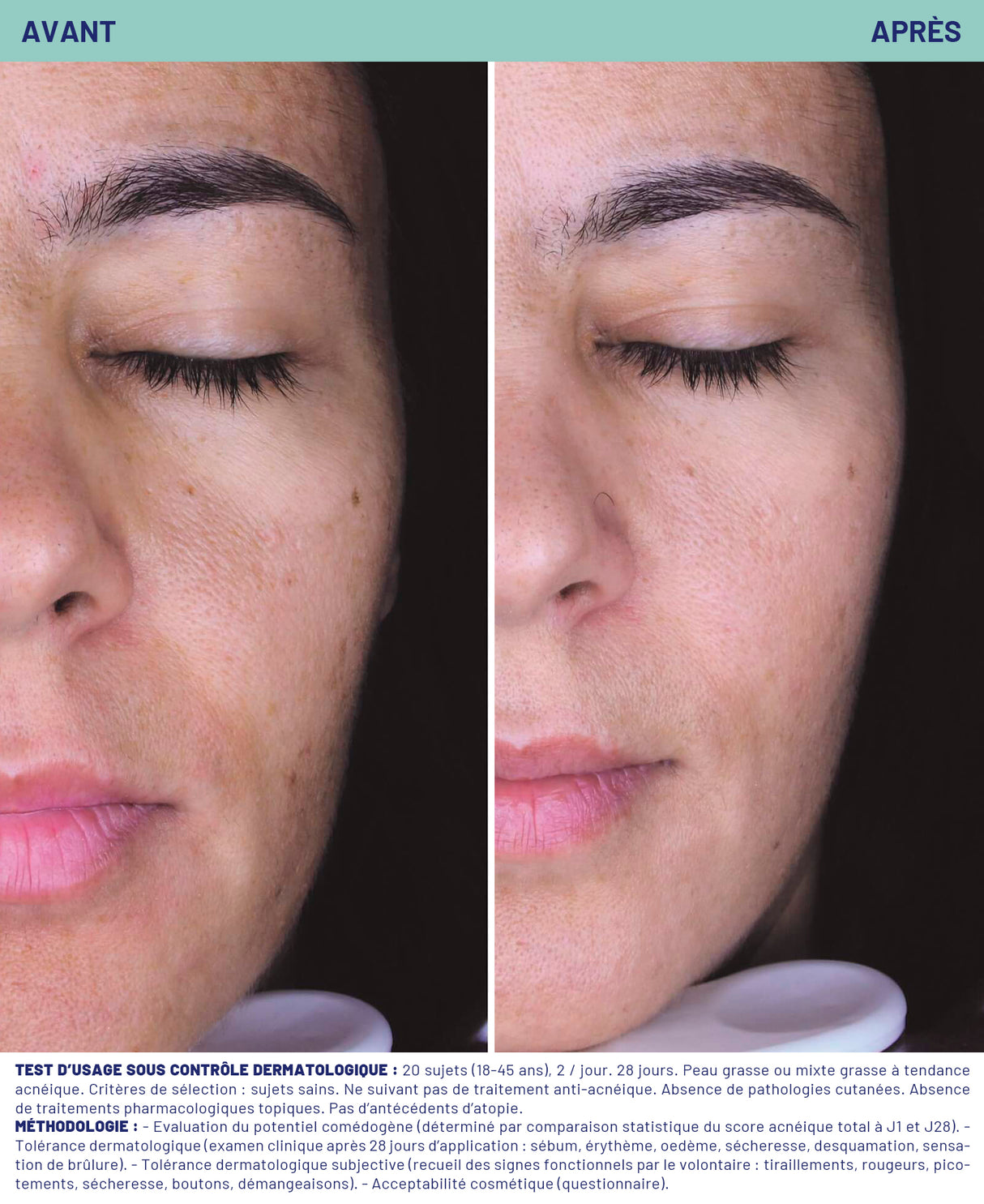 Hydratant stop imperfections Soins de jour Soskin