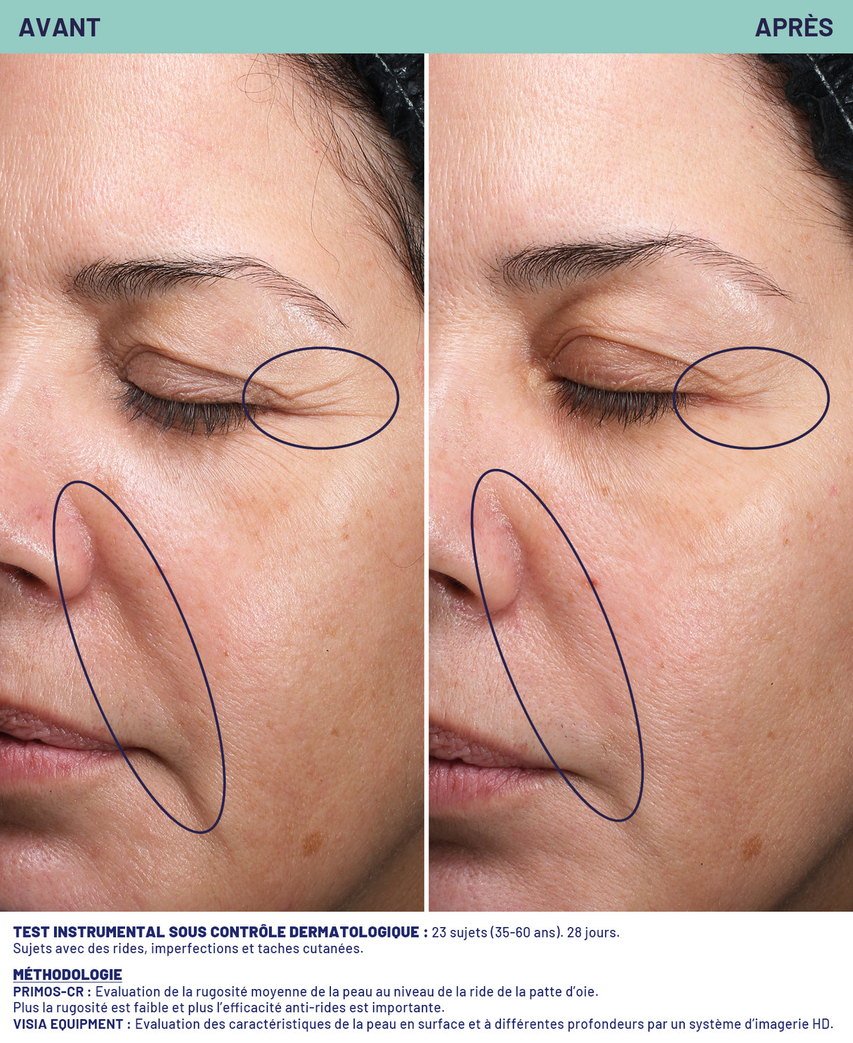 Masque lissant double action